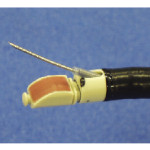 Transbronchial-Needle