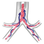 endobronchial-laser