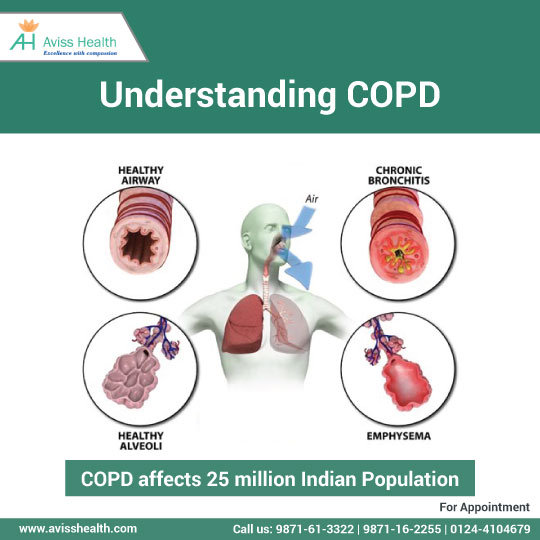 Obstructive Lung Disease or COPD : Here Is All That You Need To Know